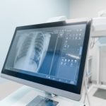 computer monitor showing x-rays